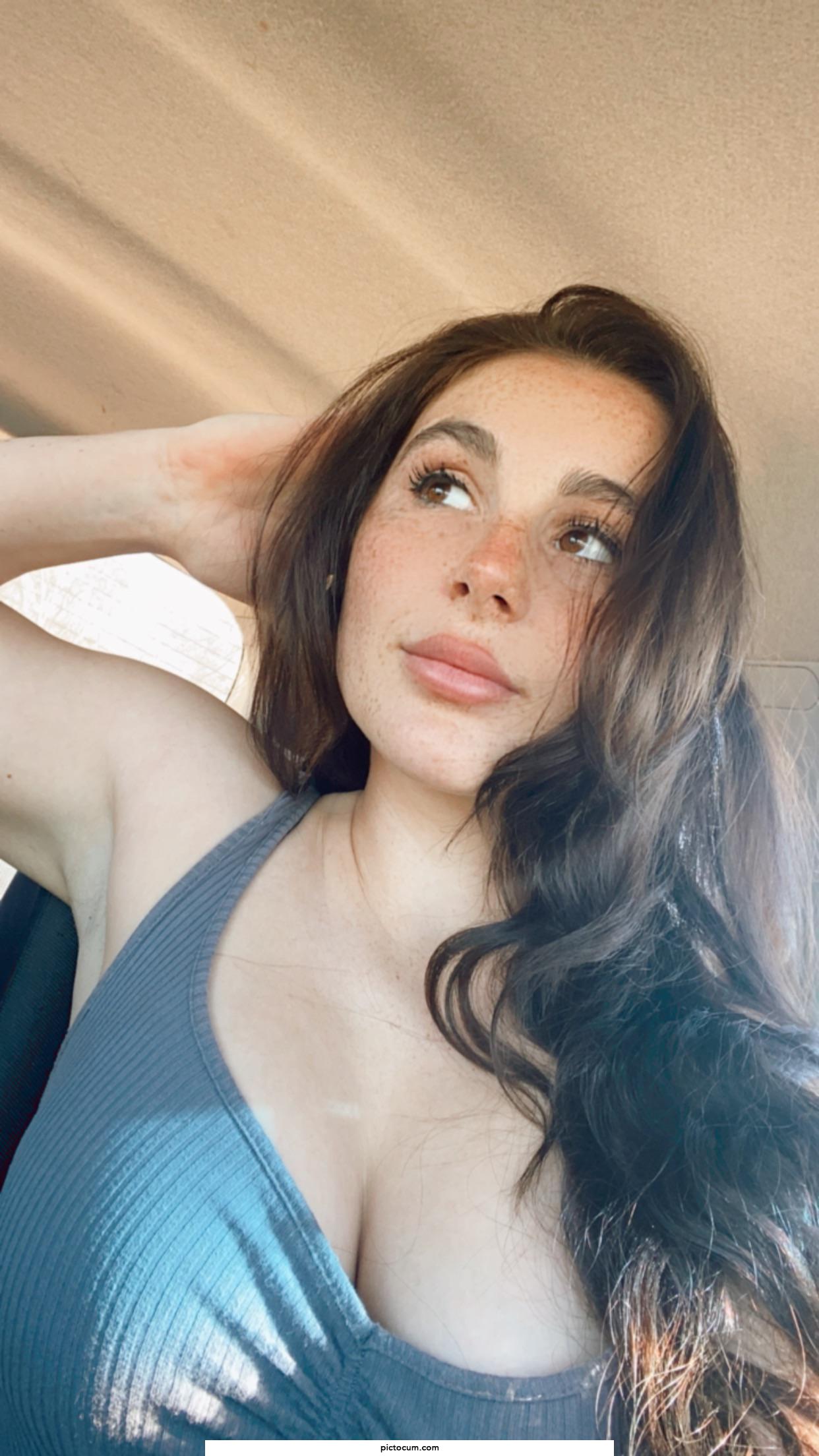 Freckles