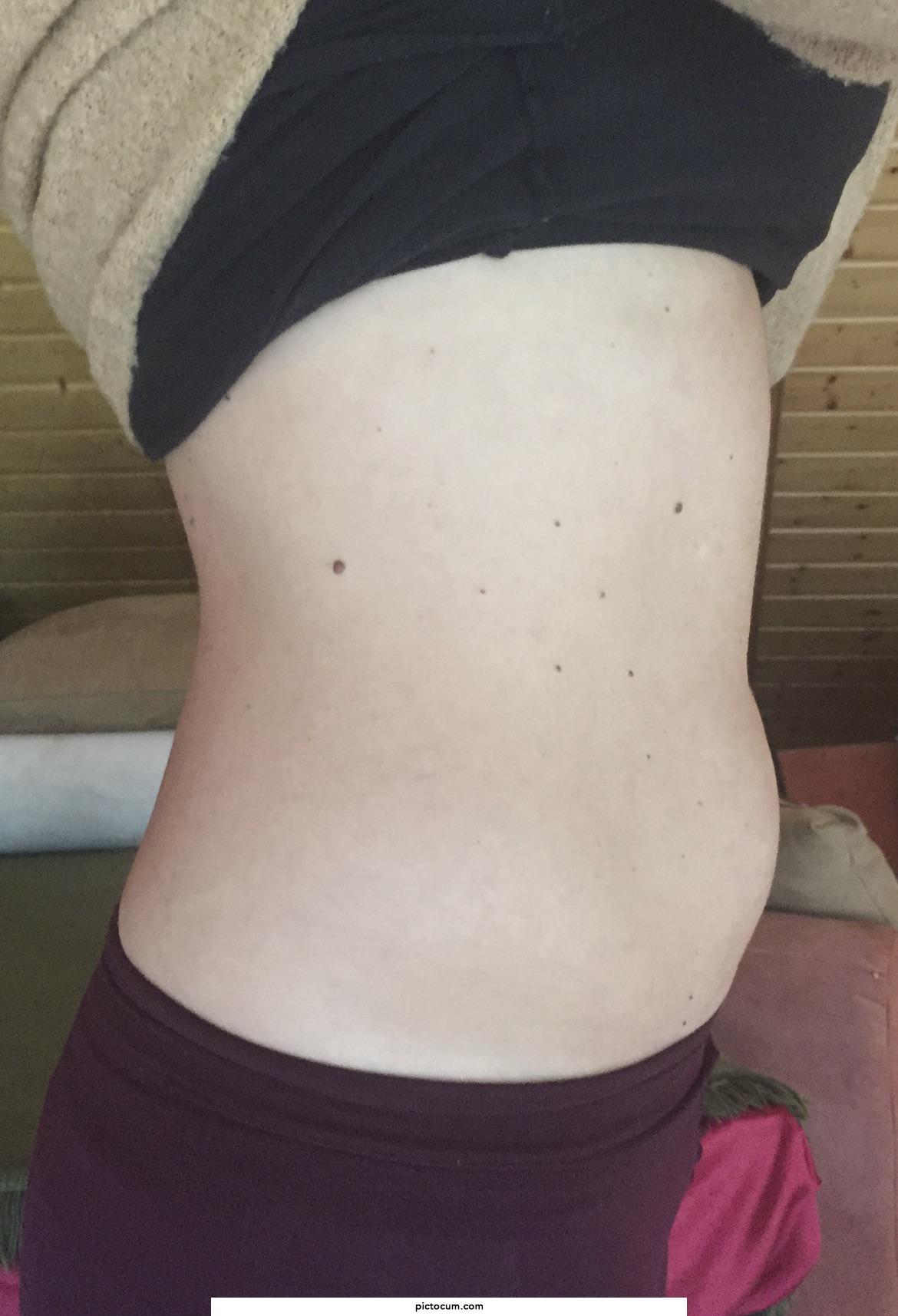 who else has a wife with a lot of moles and thinks it's incredibly hot?