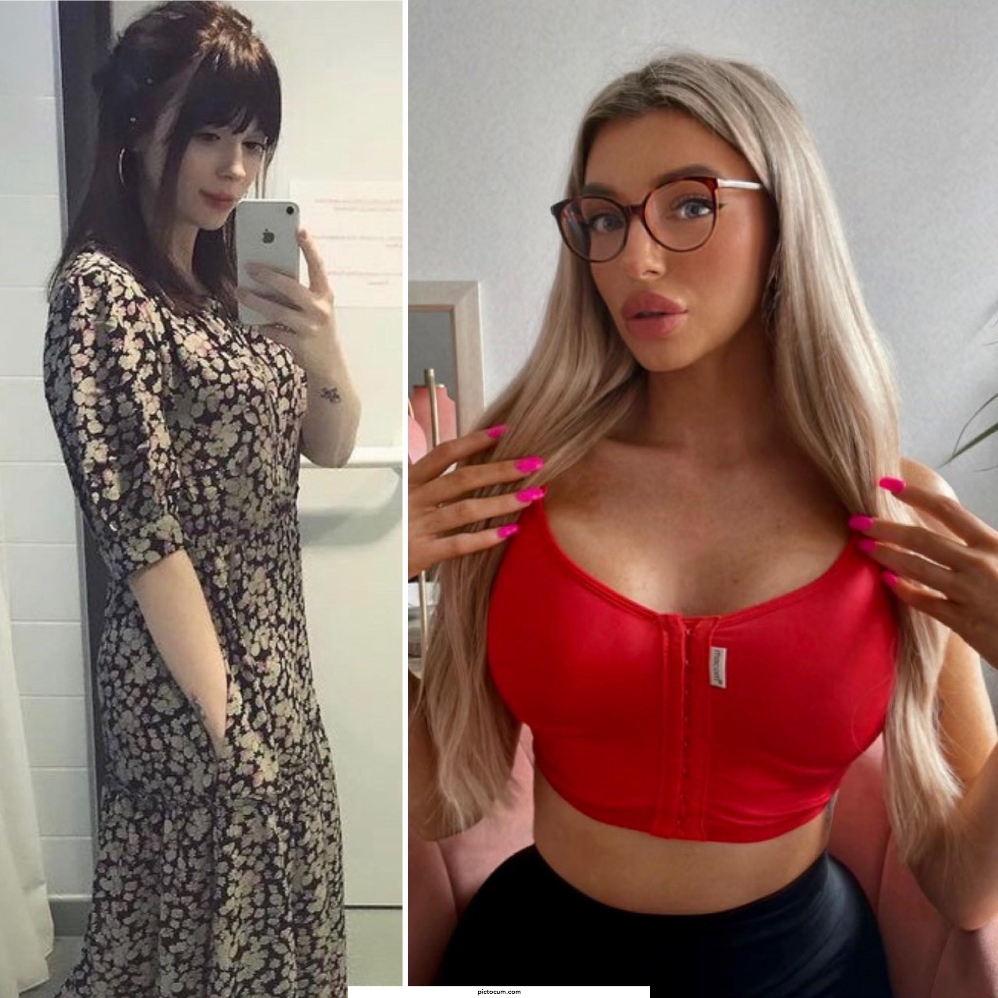 My bimbo transformation so far. New tits ✅ New lips ✅ New hair ✅ New nails ✅ New physique ✅ and more to come 🥰