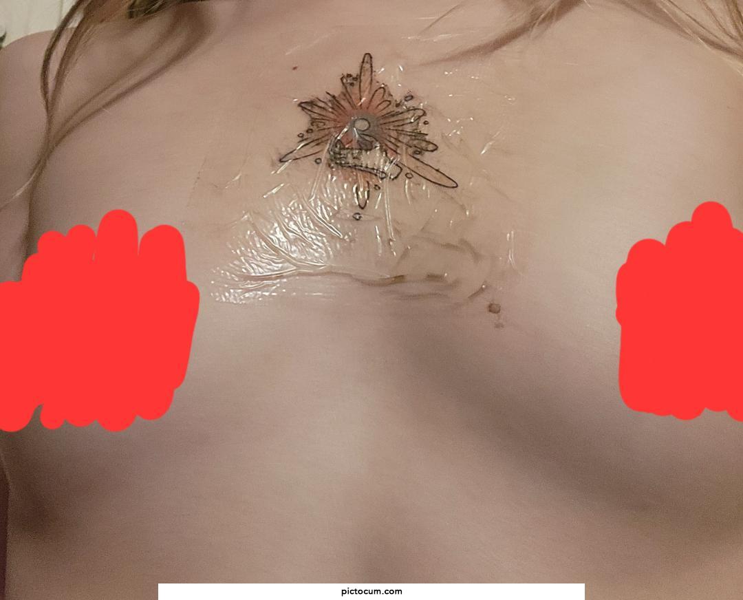 Def. ready to remove this saniderm tonight!