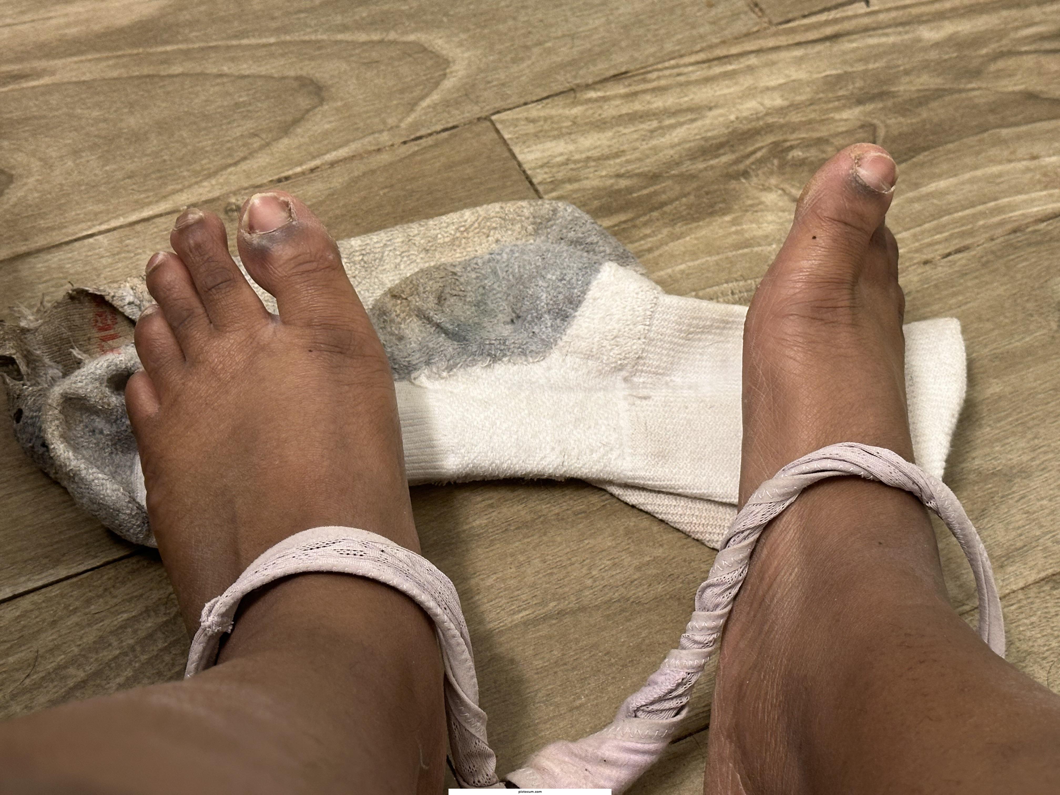 Just got after my day at the job site what can I do to make my feet look better! Yes I’m a woman 😉